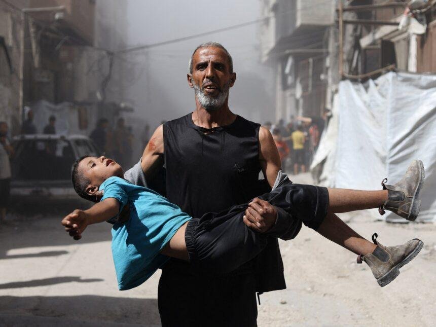 Foreign doctors say Israel systematically targeting Gaza’s children: Report | Israel-Palestine conflict News