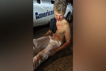 Former DOGE employee Edward "Big Balls" Coristine was attacked Monday while trying to help a woman, according to sources.